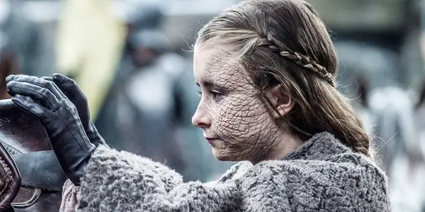 Sostų žaidimas: Kodėl Shireen Baratheon mirtis buvo tragiškiausia